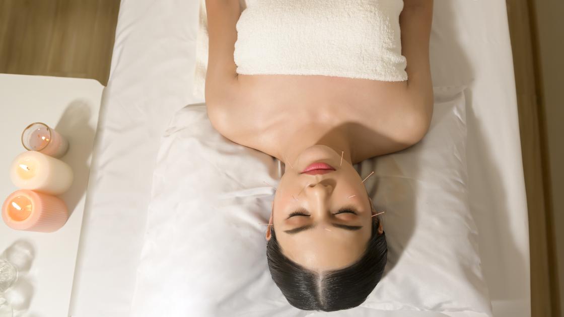 Acupuncture